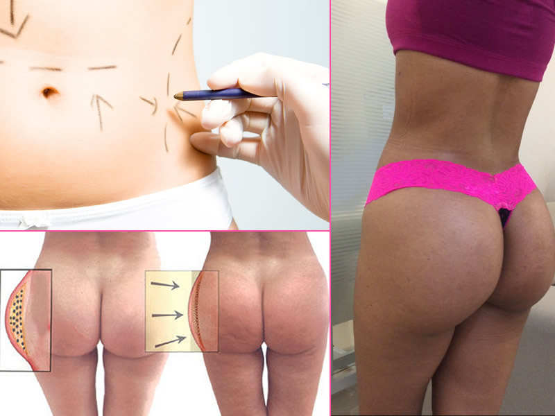 Médico de cirugía estética en el Quindío Eje Cafetero